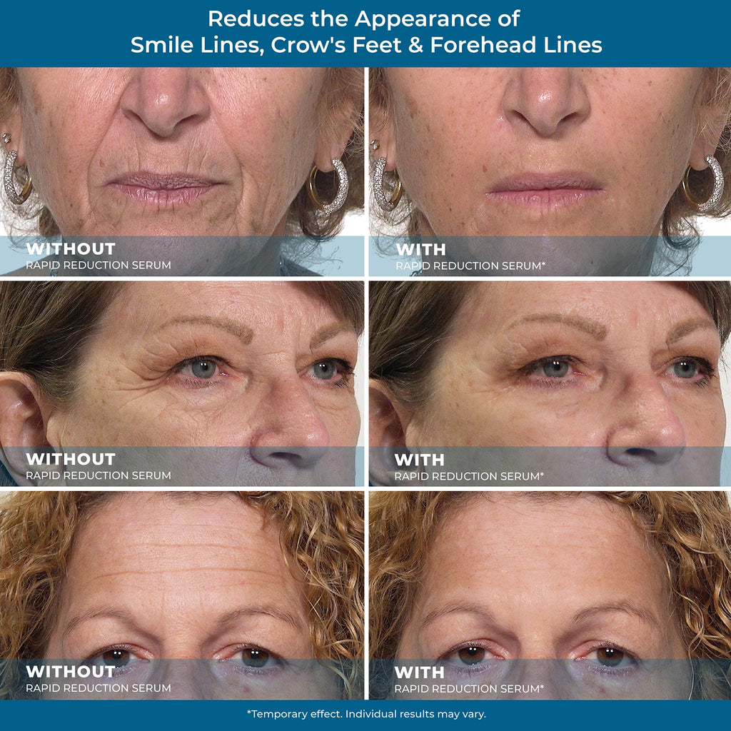 Rapid Reduction Serum – 1-Month Supply